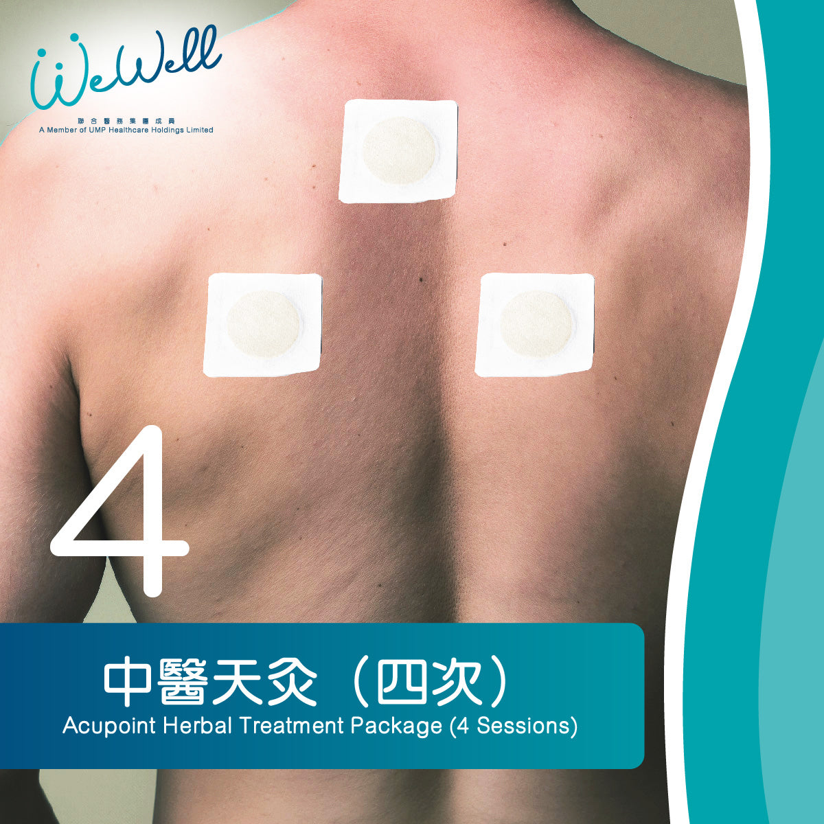 中醫天灸 (四次) (SCH-TCM-00025)