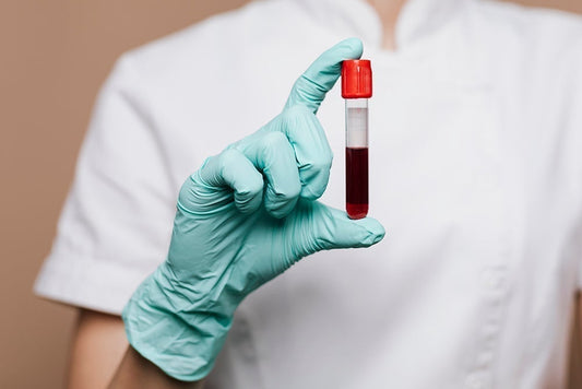 甲種胚胎蛋白(腫瘤指標-肝) Alpha-Fetoprotein (AFP- Liver)