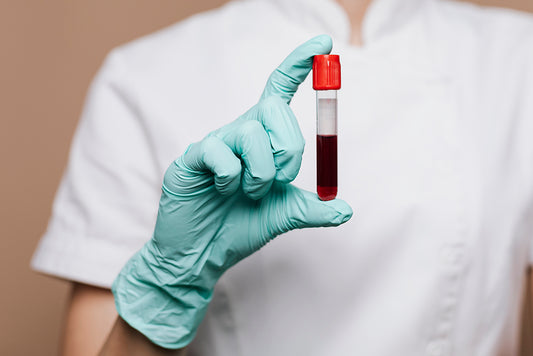 總甲型肝炎抗體IgG Hepatitis A Virus Antibody IgG